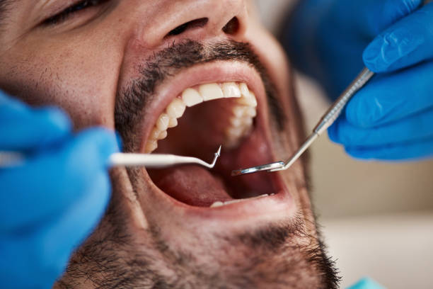 Best Same-Day Emergency Dental Services in Memphis, TX